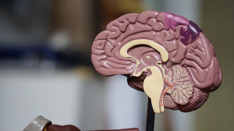 Neuro Surgery